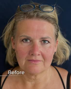 Slider image (2) Boroyan Plastic Surgery in Yerevan Armenia